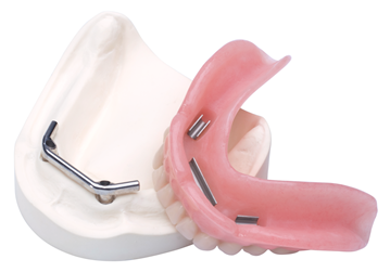 Bedrijf Continu man Implantaat Prothese • Elysee Dental Productgroep