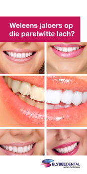 patientenflyers orthodontie tandtechniek tanden witten